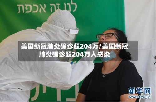 美国新冠肺炎确诊超204万/美国新冠肺炎确诊超204万人感染